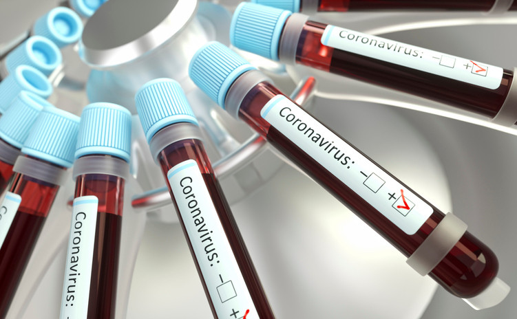 New coronavirus antibody test 