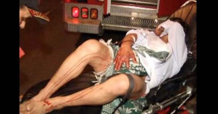 Una mujer desnudó y casi le corta el pene a venezolano que intentó ...