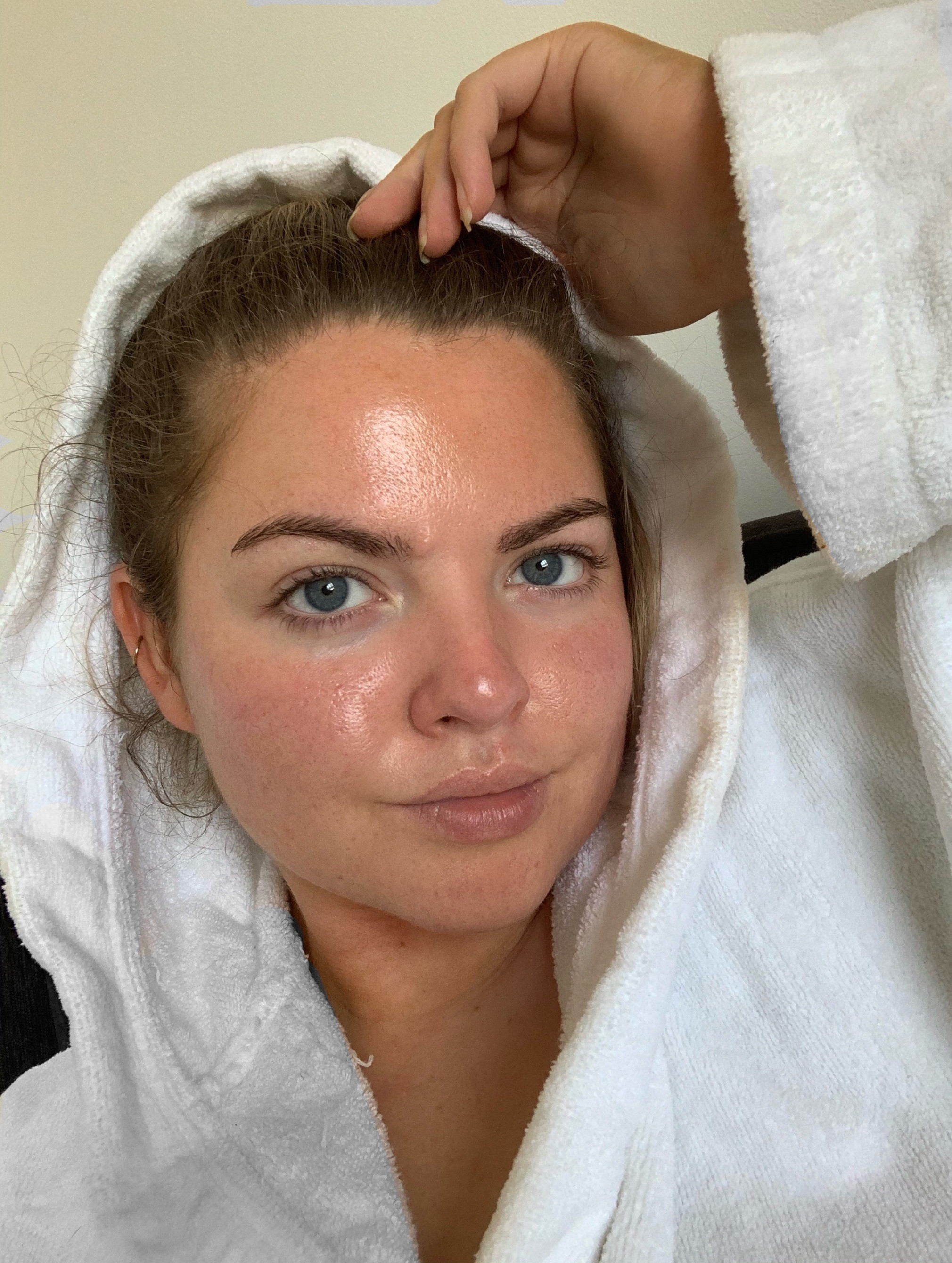 Woman With Severe Acne Tried A £17.99 Tanning Water That Cleared Up Her