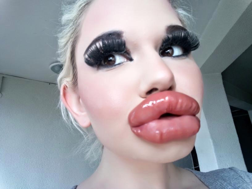 Real Life Barbie Had Her 20th Lip Injection But Still Wants Her Lips Bigger Small Joys
