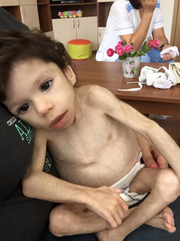 Encuentran a un pequeño en un orfanato cubierto de pelo tras aguantar 7 años hambriento