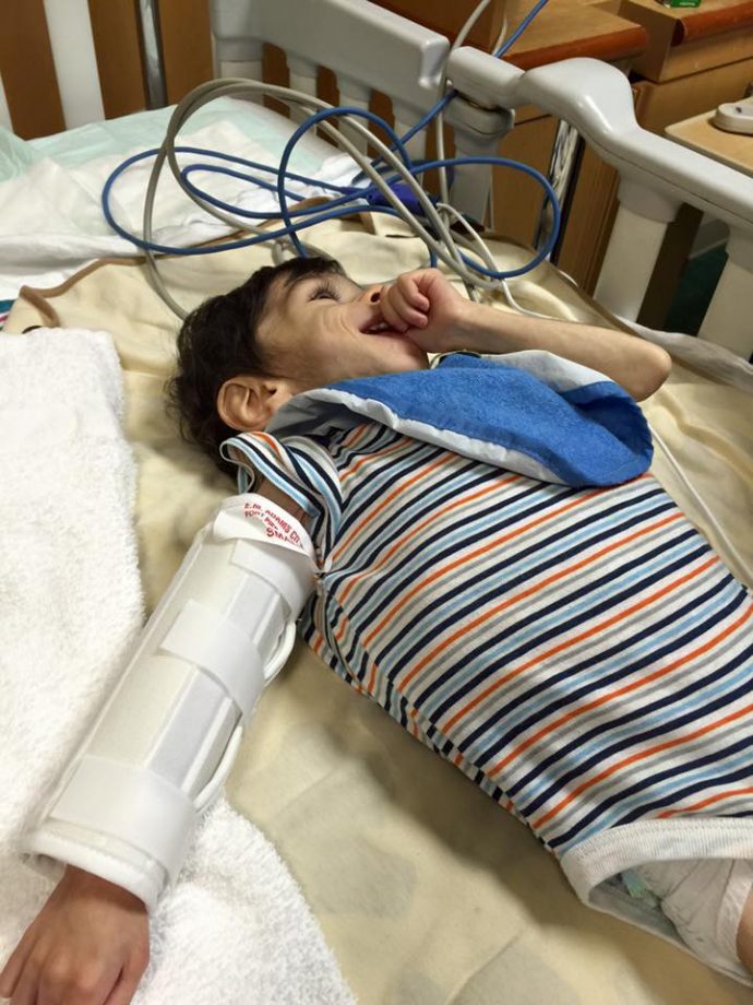 Encuentran a un pequeño en un orfanato cubierto de pelo tras aguantar 7 años hambriento