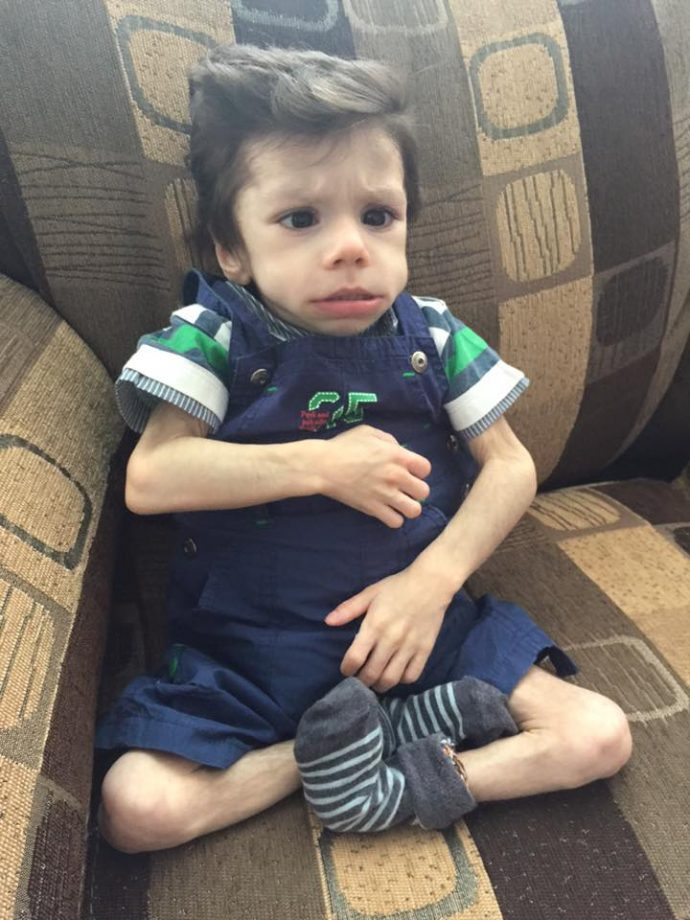 Encuentran a un pequeño en un orfanato cubierto de pelo tras aguantar 7 años hambriento