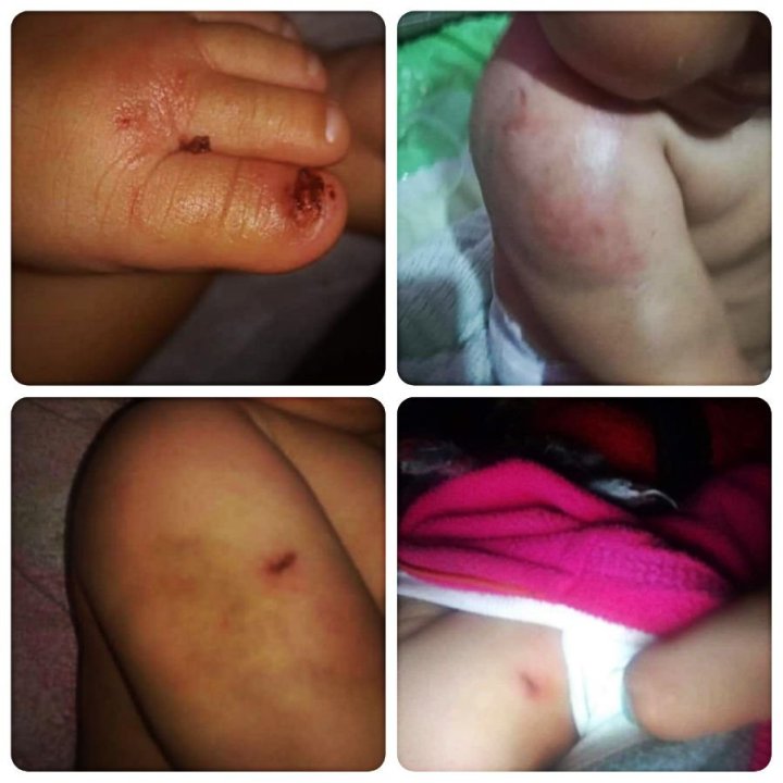 Madre filma agresiones contra su hija de un año para mandárselos a ...