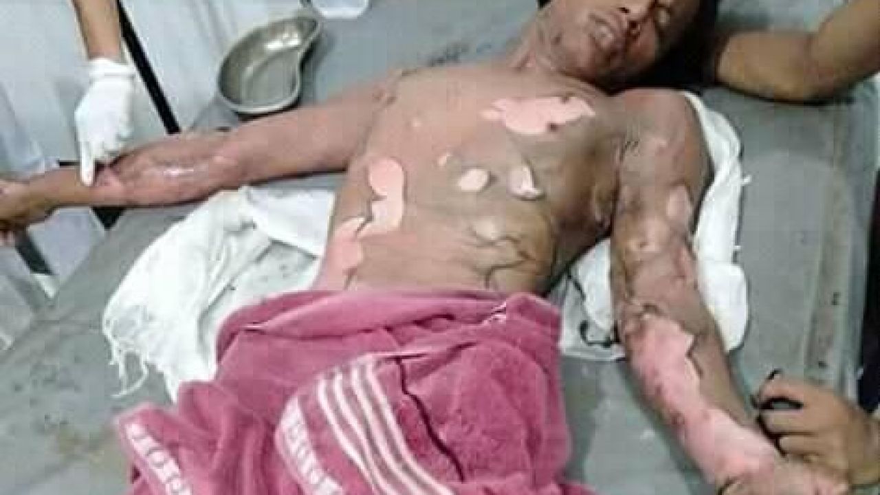 Una mujer quema vivo a su marido porque no le daba la contraseña ...