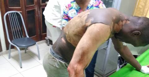 Mujer prende fuego a su marido mientras estaba acostado