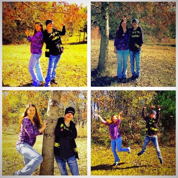 El fuego le arrebató su rostro, pero no dejó de luchar - Infobae