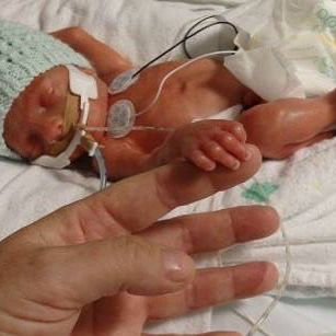 14weekspremature Instagram posts - Gramho.com