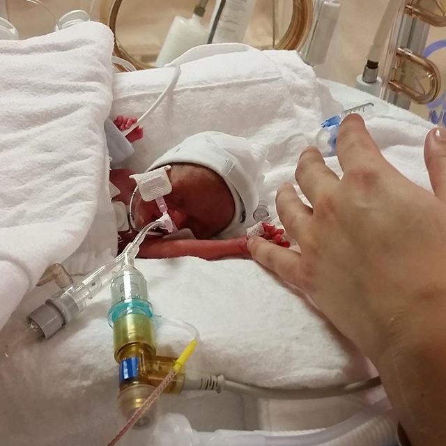 14weekspremature Instagram posts - Gramho.com