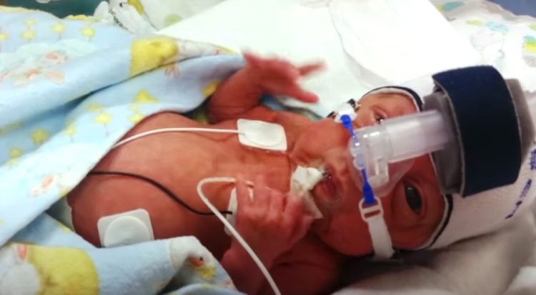 Pesaba medio kilo y contrajo más de 10 enfermedades, pero ella ...