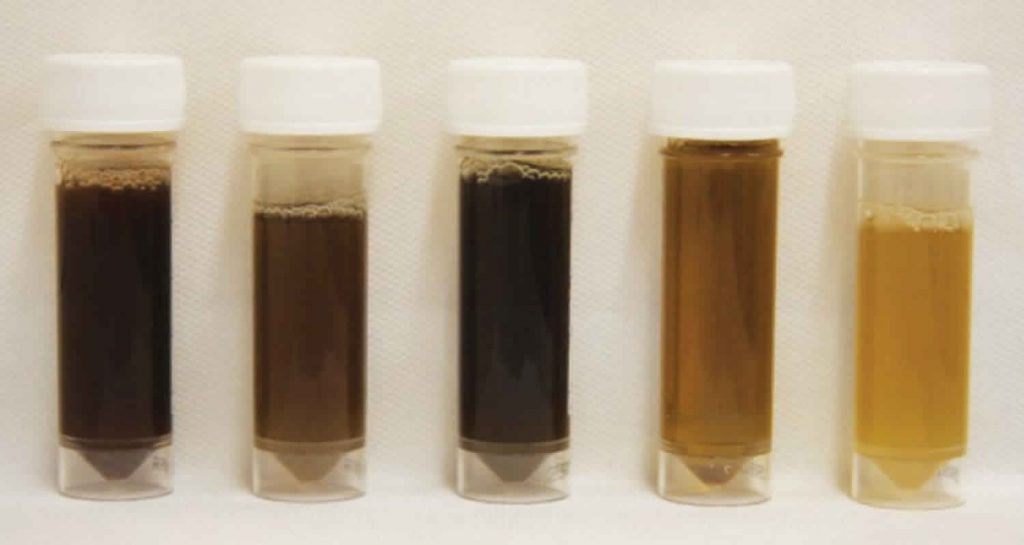 Differentiating healthy urine color