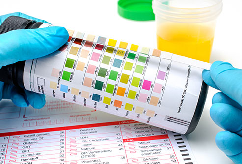 Identifying healthy urine color