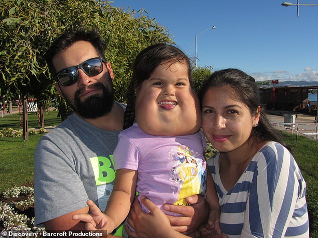 The family say they had to put up with cruel comments as well as supportive ones, and doctors had been too nervous to operate on the growth because it was so large â when it was eventually removed, part of it bled a lot because it was so well connected to blood vessels