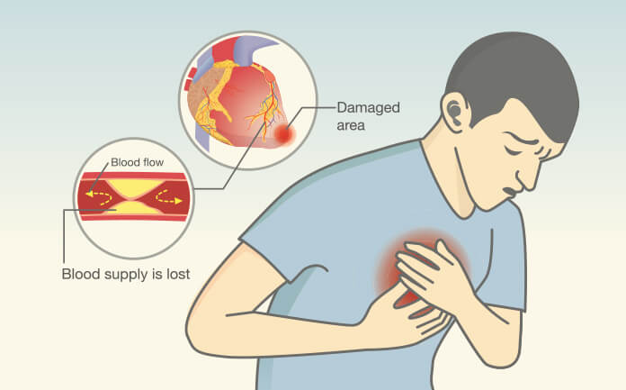 10-poor-blood-circulation-symptoms-that-require-immediate-attention