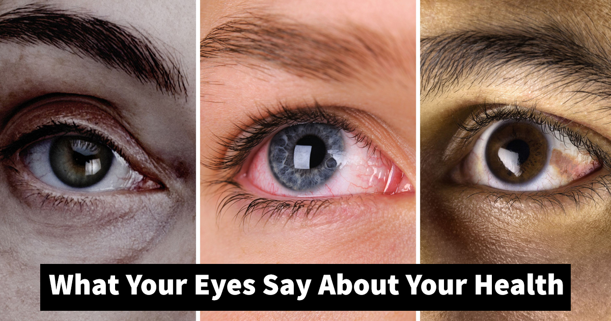 7-signs-to-know-what-your-eyes-say-about-your-health