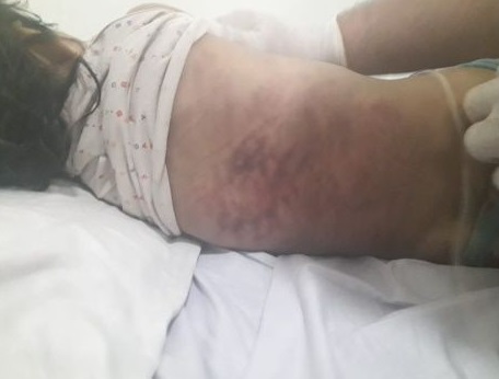 Una niña de 3 años fue golpeada salvajemente por sus "padres"; se ...