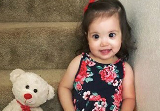 Madre Revela Que Los Ojos Hermosos De Su Hija De 2 Años Son En Realidad Una Rara Enfermedad 3960