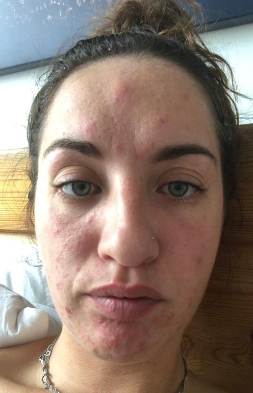 Atribuyó un dolor de cabeza al cansancio pero su cuerpo estaba ...