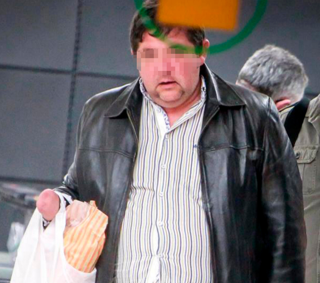 El hombre que se cortó la mano para cobrar el seguro | Crónica ...