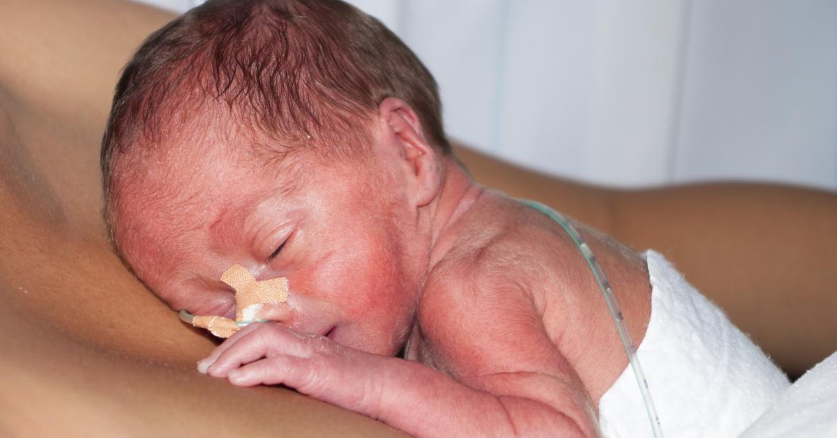 Los beneficios del contacto entre los bebés prematuros y sus ...