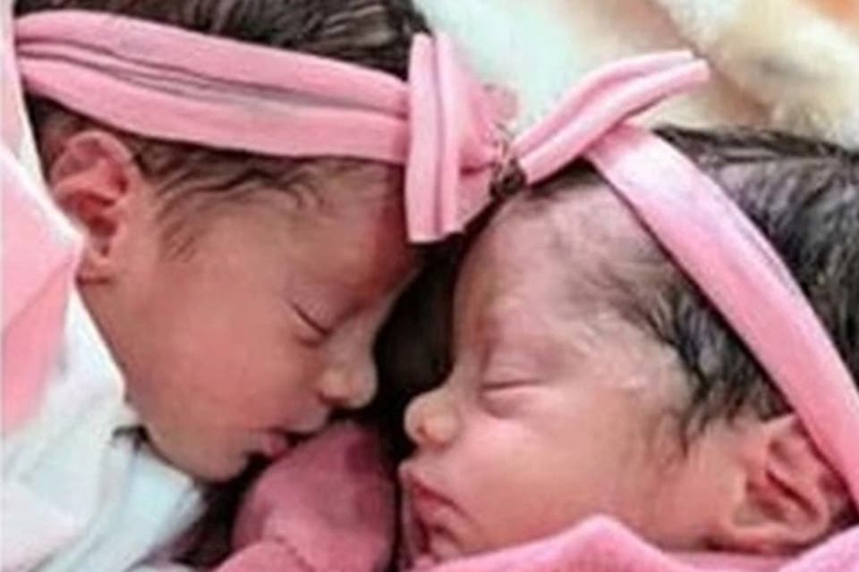 En un trágico incidente, un perro celoso mató a dos gemelas recién ...