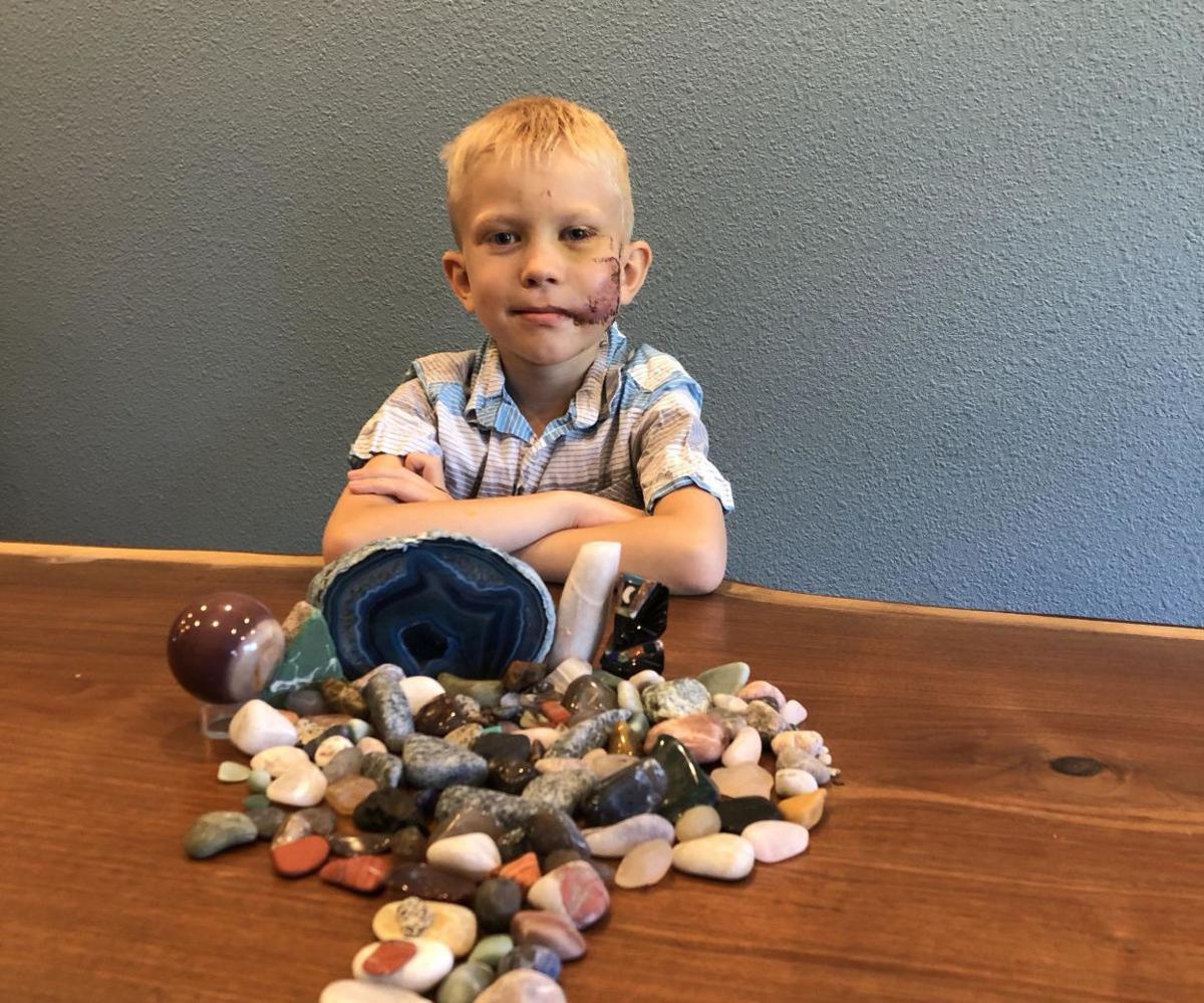 Cheyenne boy goes viral after protecting sister from dog attack ...