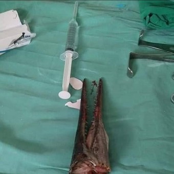 Un joven fue atacado por un pez espada: "Saltó del agua y me ...