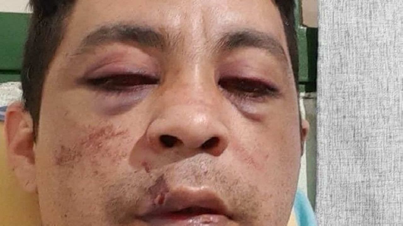 Enfermero fue golpeado y quemaron su casa por ser portador del ...