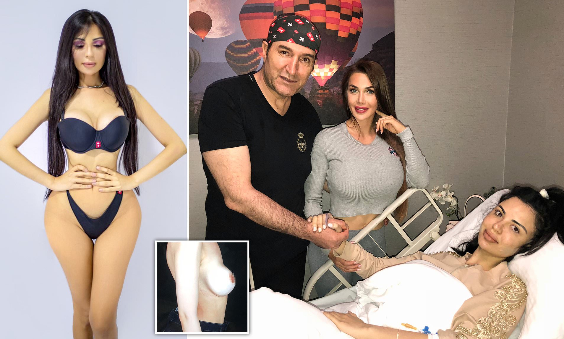 plastic surgery addict