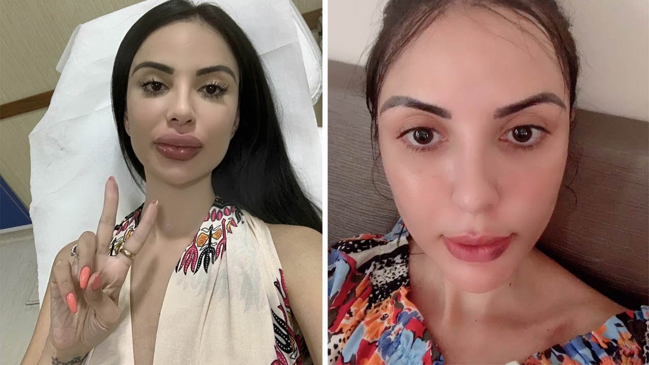 plastic surgery addict