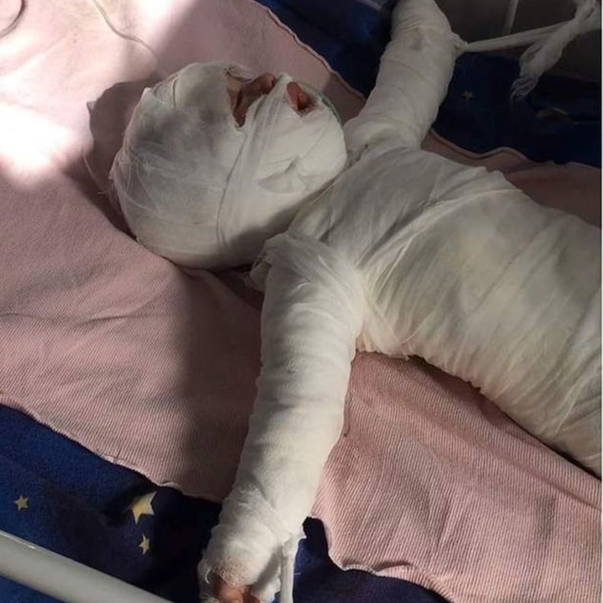 Bebé muere al caer en balde de agua hirviendo | EL DEBATE