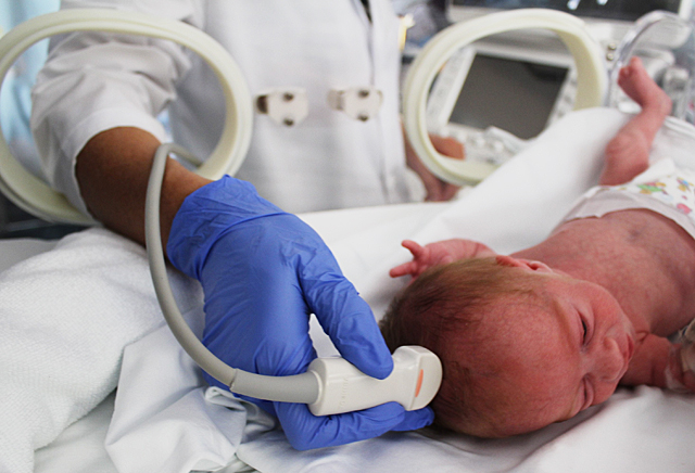 Naciste prematuro? Conoce como es tu cerebro