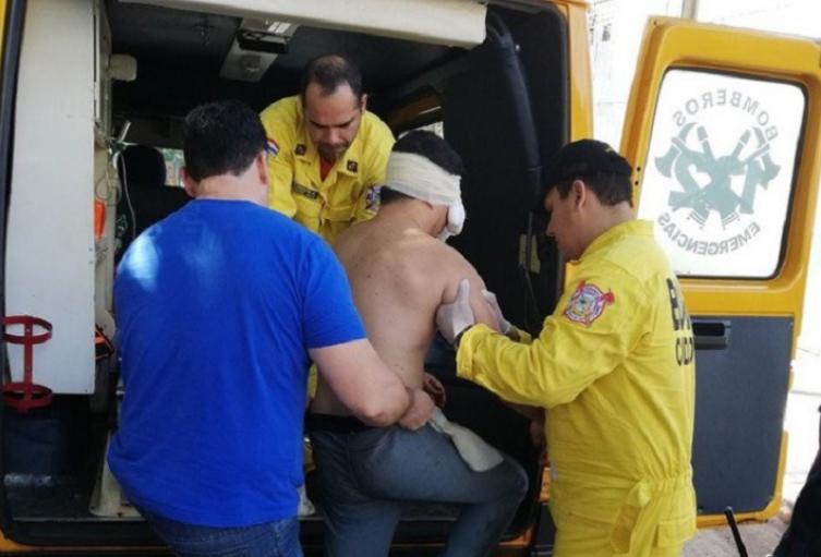 Brasileño se se sacó un ojo y casi se mutila su órgano genital | Alerta Bogotá