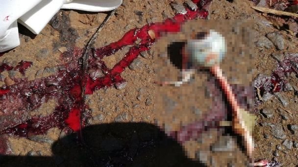 Terrible: un hombre se sacó los ojos con sus propias manos tras romper con su novia | El Esquiu