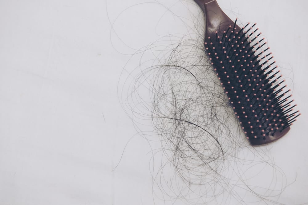 hair loss