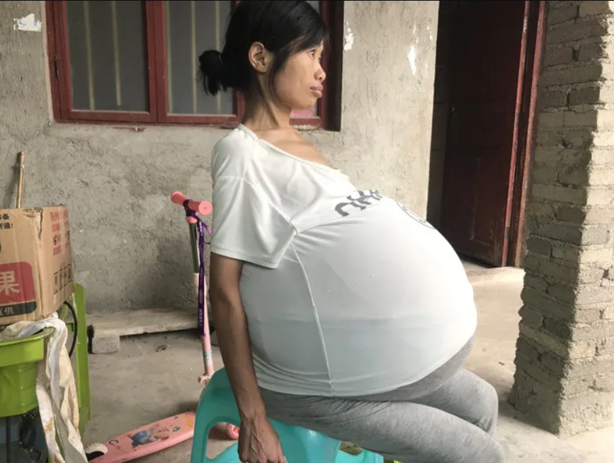 Китайский беременность. Хуан Госянь большой живот. Девочка с огромным животом.
