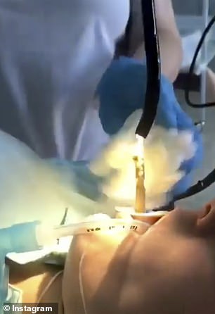 The snake is extracted from the woman