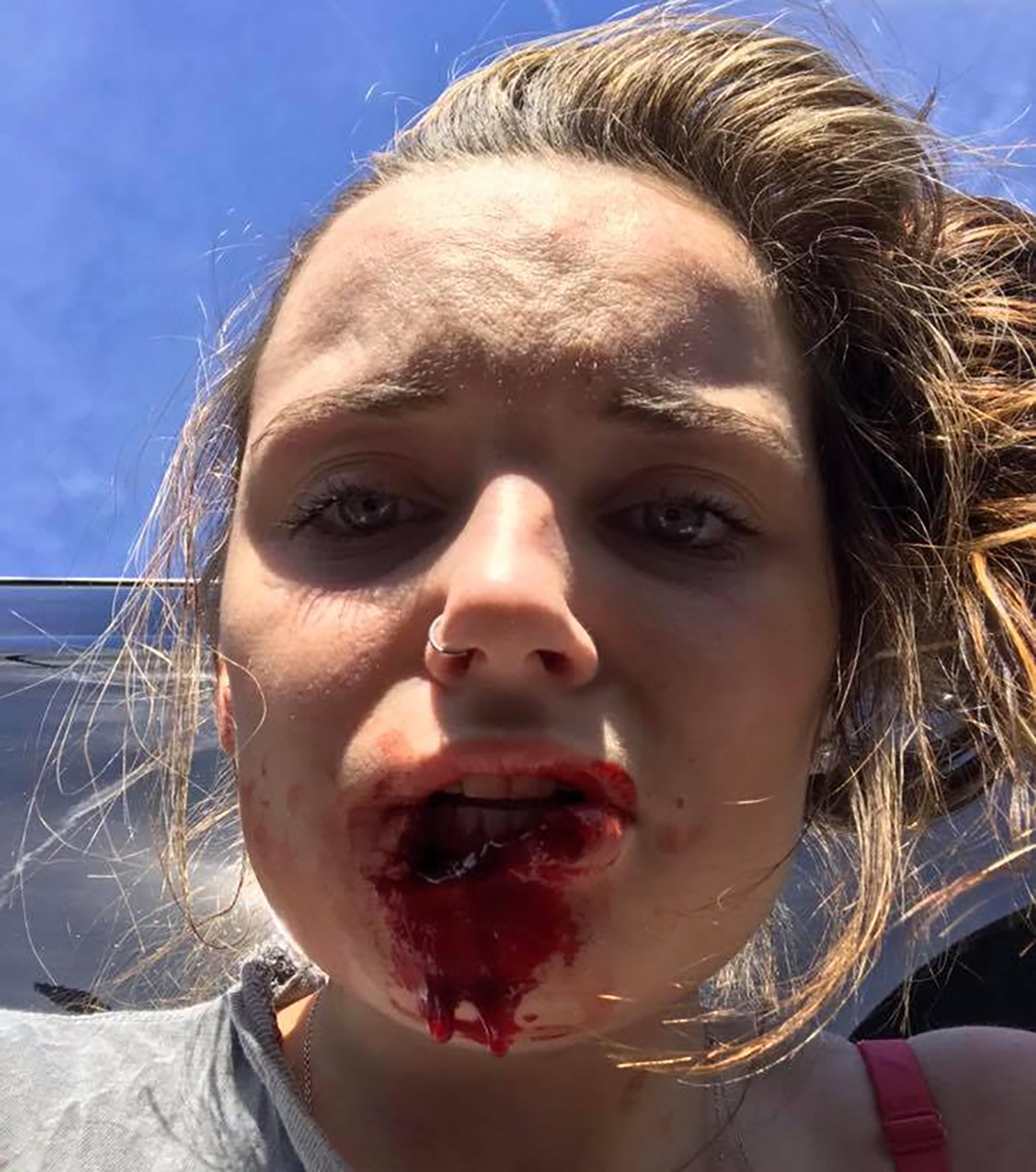 Condenado a 12 años de prisión el estadounidense que arrancó de un mordisco el labio de su ex novia - Infobae