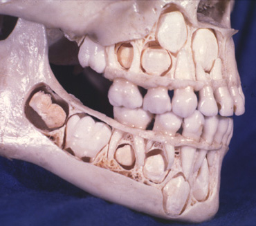 baby teeth skull photo