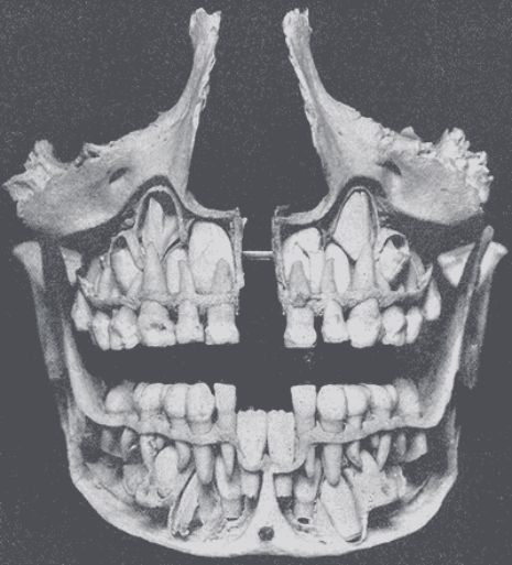 =