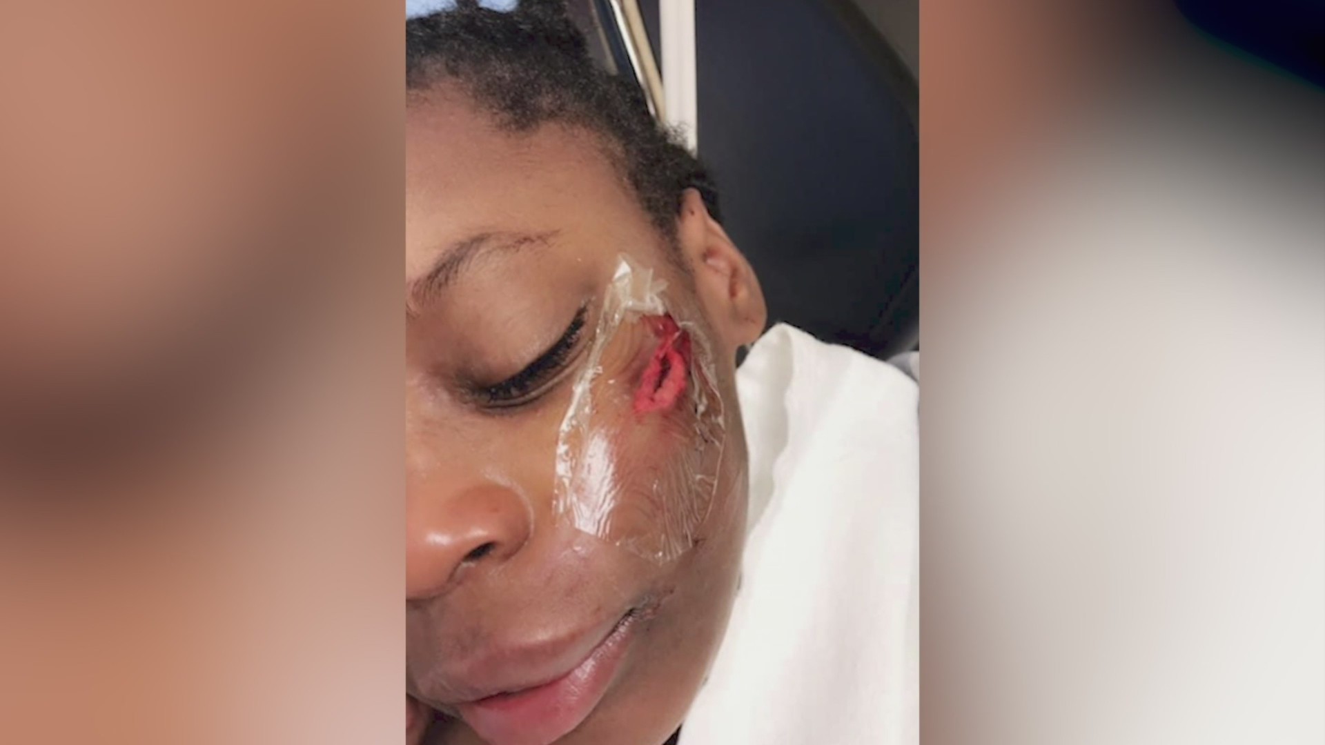 Racist Attack Leaves Young Black Girl Hospitalized Afte
