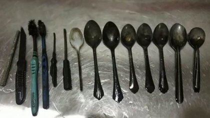 El hombre llegó al hospital quejándose de un fuerte dolor de estómago (Foto: SWNS)