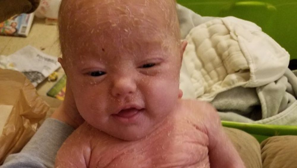 Una madre pide ayuda para pagar el tratamiento de su hija de un año: sufre lo que se conoce como