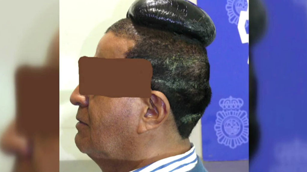 5 años de cárcel para un hombre que intentaba ocultar droga debajo de su peluquín