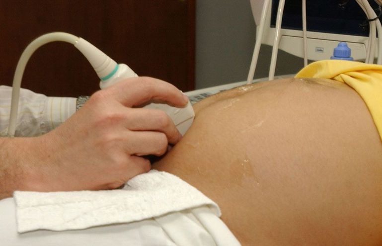 Si la vida de niña embarazada corre riesgo, interrumpirán gestación, dicen - Locales - ABC Color