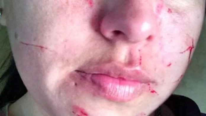 Mujer policía embarazada desfiguró a la ex de su novio | Canal 9 TV