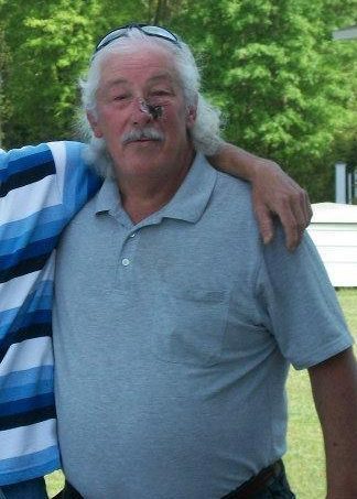 Scarred cancer survivor Kirby Evans reveals restaurant ordered him to cover his face before booting him out for