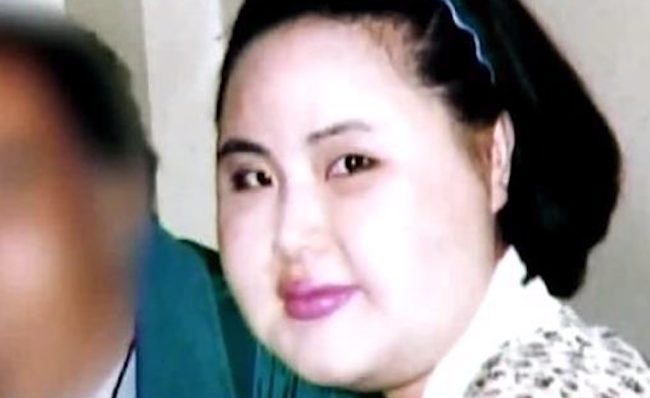 Korean Model Hang Miokus Ugly Transformation After Surgeries