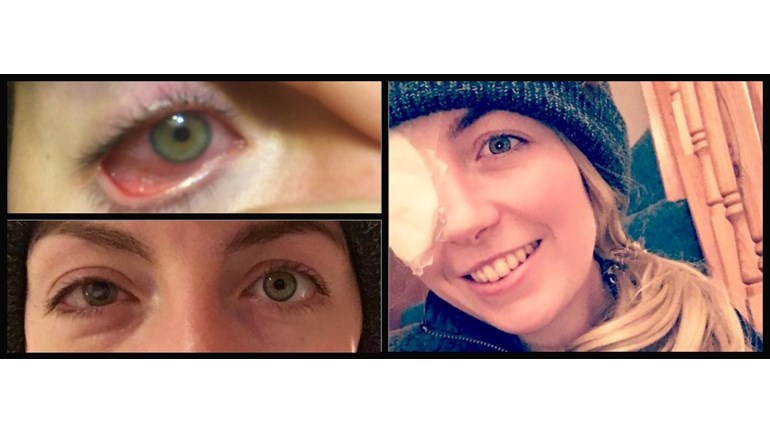 Charlotte Clarkson is fundraising for Fight for Sight