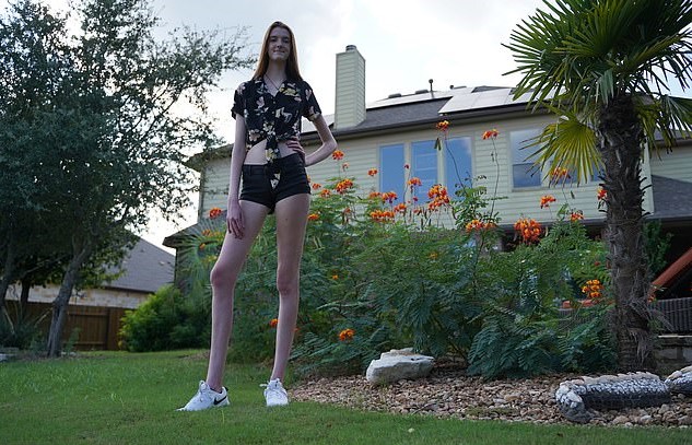 Meet The 17-Year-Old Woman Who Has The Longest Legs In The World ...